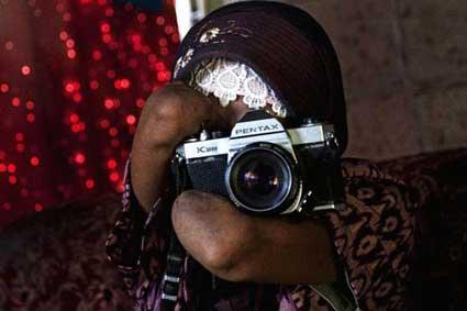 بالرغم من بتر يديها، إندونسية تحترف التصوير